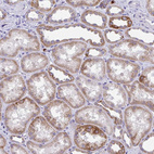 Immunohistochemical staining of human kidney shows weak to moderate granular cytoplasmic positivity in cells in tubules.