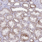 Immunohistochemical staining of human kidney shows weak to moderate granular cytoplasmic positivity in cells in tubules.