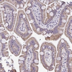 Immunohistochemical staining of human small intestine shows moderate cytoplasmic granular positivity in glandular cells.