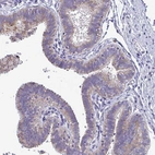 Immunohistochemical staining of human fallopian tube shows moderate cytoplasmic granular positivity in glandular cells.