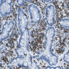Immunohistochemical staining of human duodenum shows strong membranous positivity in lymphoid cells.