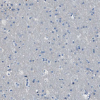 Immunohistochemical staining of human cerebral cortex shows no positivity in neurons as expected.