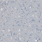 Immunohistochemical staining of human cerebral cortex shows no positivity in neurons as expected.