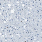 Immunohistochemical staining of human liver shows no positivity in hepatocytes as expected.