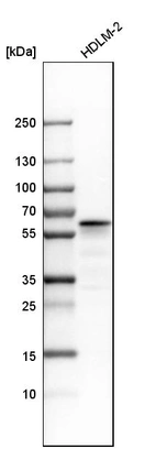 Western blot analysis in human cell line HDLM-2.