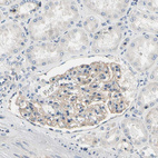Immunohistochemical staining of human kidney shows moderate membranous positivity in cells in glomeruli.