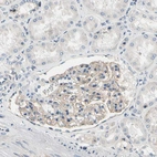 Immunohistochemical staining of human kidney shows moderate membranous positivity in cells in glomeruli.
