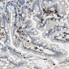 Immunohistochemical staining of human small intestine shows strong membranous/cytoplasmic positivity in enteroendocrine cells.