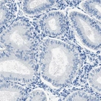 Immunohistochemical staining of human endometrium shows no positivity in glandular cells as expected.