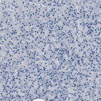 Immunohistochemical staining of human pancreas shows no positivity in exocrine glandular cells as expected.