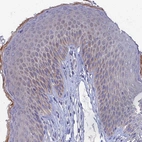 Immunohistochemical staining of human skin shows moderate cytoplasmic positivity in squamous epithelial cells.