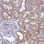 Immunohistochemical staining of human kidney shows strong cytoplasmic positivity in cells in tubules.