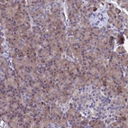 Immunohistochemical staining of human pancreas shows strong cytoplasmic positivity in exocrine glandular cells.
