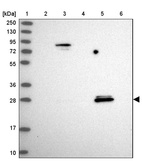 Lane 1: Marker [kDa] 250, 130, 95, 72, 55, 36, 28, 17, 10_br/_Lane 2: Human cell line RT-4_br/_Lane 3: Human cell line U-251MG sp_br/_Lane 4: Human plasma (IgG/HSA depleted)_br/_Lane 5: Human liver tissue_br/_Lane 6: Human tonsil tissue