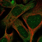 Immunofluorescent staining of human cell line U-2 OS shows localization to nucleoli & cytosol.