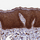 Immunohistochemical staining of human skin shows strong cytoplasmic positivity in squamous epithelial cells.