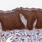 Immunohistochemical staining of human skin shows strong cytoplasmic positivity in squamous epithelial cells.