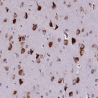 Immunohistochemical staining of human cerebral cortex shows strong cytoplasmic positivity in neurons.