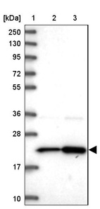 Lane 1: Marker [kDa] 250, 130, 95, 72, 55, 36, 28, 17, 10_br/_Lane 2: Human cell line RT-4_br/_Lane 3: Human cell line U-251MG sp