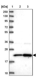Lane 1: Marker [kDa] 250, 130, 95, 72, 55, 36, 28, 17, 10_br/_Lane 2: Human cell line RT-4_br/_Lane 3: Human cell line U-251MG sp