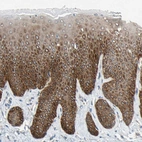 Immunohistochemical staining of human skin shows strong cytoplasmic positivity in squamous epithelial cells.