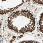 Immunohistochemical staining of human testis shows strong cytoplasmic positivity in cells in seminiferous ducts.