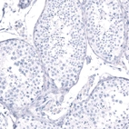 Immunohistochemical staining of human testis shows no positivity in cells in seminiferous ducts as expected.