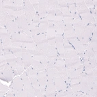 Immunohistochemical staining of human skeletal muscle shows no cytoplasmic positivity in myocytes as expected.