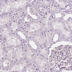 Immunohistochemical staining of human kidney shows no positivity in cells in tubules as expected.