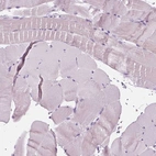 Immunohistochemical staining of human skeletal muscle shows no positivity in myocytes as expected.