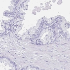 Immunohistochemical staining of human prostate shows no positivity in glandular cells as expected.