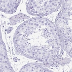 Immunohistochemical staining of human testis shows no positivity in cells in seminiferous ducts as expected.