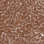 Immunohistochemical staining of human liver shows strong cytoplasmic positivity in hepatocytes.