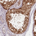 Immunohistochemical staining of human testis shows strong cytoplasmic and nulcear positivity in cells in seminiferous ducts.