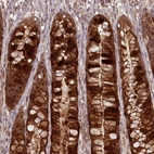 Immunohistochemical staining of human rectum shows strong cytoplasmic positivity in glandular cells.