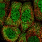 Immunofluorescent staining of human cell line A-431 shows localization to nucleoplasm & cytosol.
