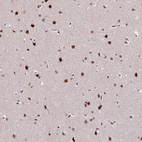 Immunohistochemical staining of human cerebral cortex shows strong nuclear positivity in neurons.