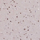 Immunohistochemical staining of human cerebral cortex shows strong nuclear positivity in neurons.