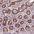 Immunohistochemical staining of human duodenum shows moderate cytoplasmic-nuclear positivity in glandular cells.
