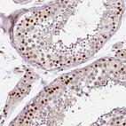 Immunohistochemical staining of human testis shows strong nuclear positivity in cells in seminiferous ducts.