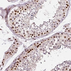 Immunohistochemical staining of human testis shows strong nuclear positivity in cells in seminiferous ducts.