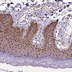 Immunohistochemical staining of human skin shows strong cytoplasmic-nuclear positivity in squamous epithelial cells.