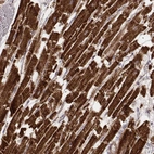 Immunohistochemical staining of human heart muscle shows strong cytoplasmic positivity in cardiomyocytes.