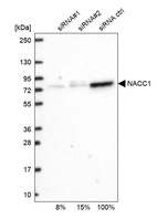 Western blot analysis in U2OS cells transfected with control siRNA, target specific siRNA probe #1 and #2, using Anti-NACC1 antibody. Remaining relative intensity is presented.