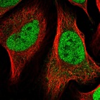 Immunofluorescent staining of human cell line U-2 OS shows localization to nucleoplasm.