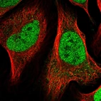 Immunofluorescent staining of human cell line U-2 OS shows localization to nucleoplasm.