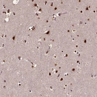 Immunohistochemical staining of human cerebral cortex shows strong nuclear positivity in neurons.