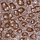 Immunohistochemical staining of human duodenum shows strong cytoplasmic-nuclear positivity in glandular cells.