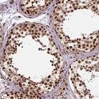 Immunohistochemical staining of human testis shows strong nuclear positivity in cells in seminiferous ducts.