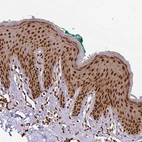 Immunohistochemical staining of human skin shows strong cytoplasmic-nuclear positivity in squamous epithelial cells.